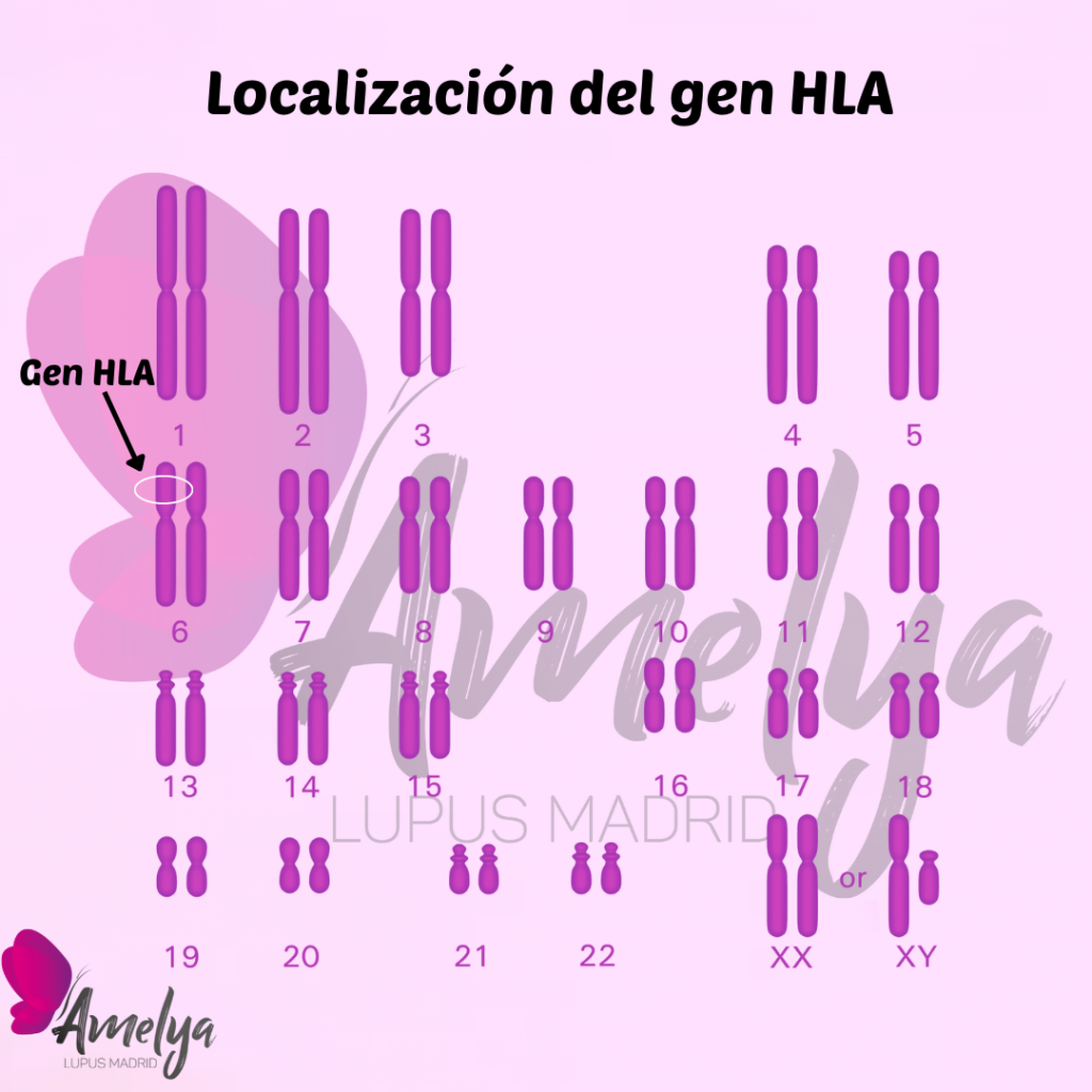 Mapa del cariotipo humano con la localización del gen HLA en el cromosoma 6. En este gen se encuentra el alelo RB1*03:01