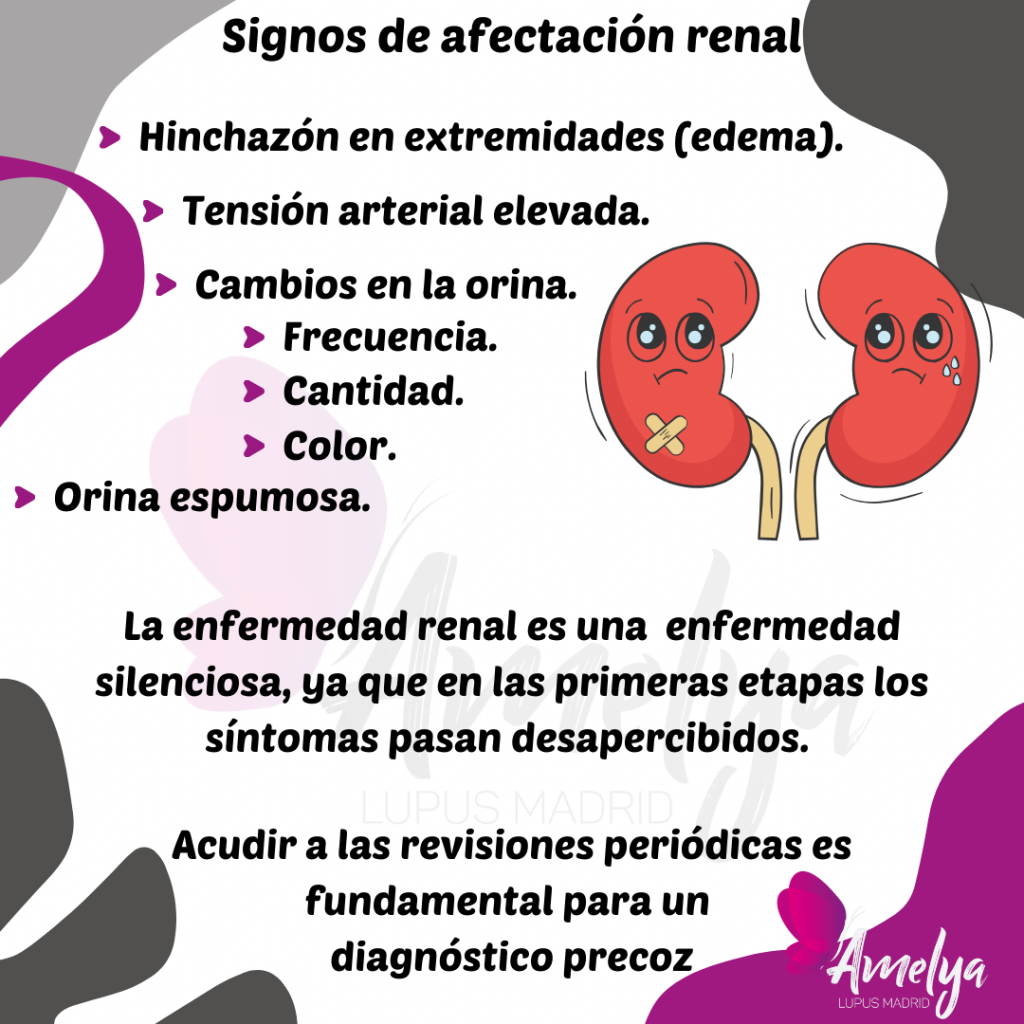 Imagen con los síntomas de afectación renal:

Edema, tensión arterial alta, cambios en la orina, orina espumosa.